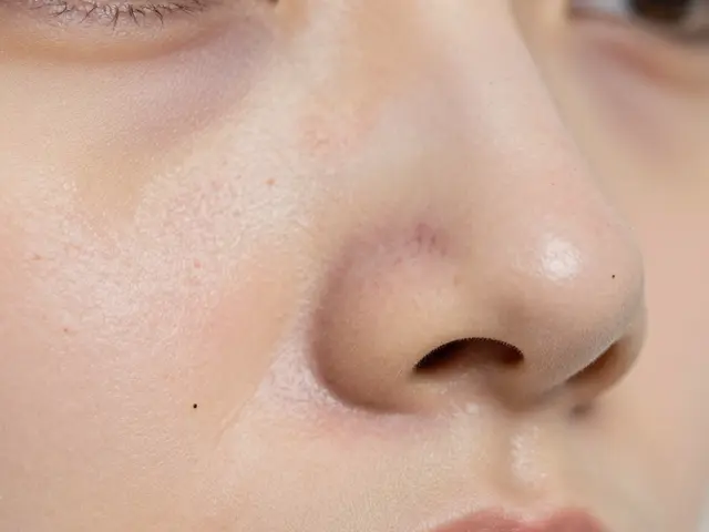 Co je nejlepší na černé tečky? Skutečné řešení, které funguje